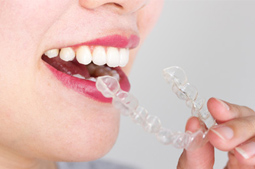 Invisalign